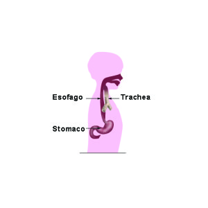 Come si presenta un esofago sano